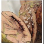 foie gras